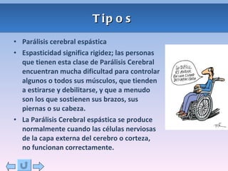 Tipos Parálisis cerebral espástica Espasticidad significa rigidez; las personas que tienen esta clase de Parálisis Cerebral encuentran mucha dificultad para controlar algunos o todos sus músculos, que tienden a estirarse y debilitarse, y que a menudo son los que sostienen sus brazos, sus piernas o su cabeza. La Parálisis Cerebral espástica se produce normalmente cuando las células nerviosas de la capa externa del cerebro o corteza, no funcionan correctamente. 