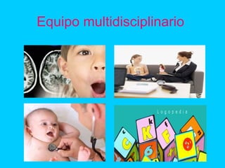Equipo multidisciplinario
 