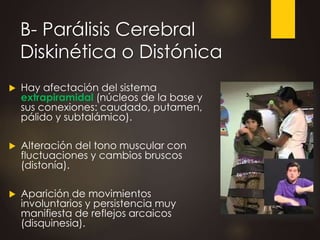 B- Parálisis Cerebral
Diskinética o Distónica
 Hay afectación del sistema
extrapiramidal (núcleos de la base y
sus conexiones: caudado, putamen,
pálido y subtalámico).
 Alteración del tono muscular con
fluctuaciones y cambios bruscos
(distonía).
 Aparición de movimientos
involuntarios y persistencia muy
manifiesta de reflejos arcaicos
(disquinesia).
 
