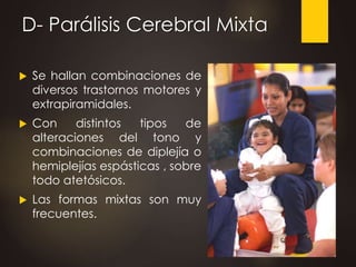 D- Parálisis Cerebral Mixta
 Se hallan combinaciones de
diversos trastornos motores y
extrapiramidales.
 Con distintos tipos de
alteraciones del tono y
combinaciones de diplejía o
hemiplejías espásticas , sobre
todo atetósicos.
 Las formas mixtas son muy
frecuentes.
 