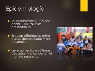 Epidemiología
 Mundialmente 2 - 2,5 por
cada 1000 RN vivos
presentan PC.
 Escasas diferencias entre
países desarrollados y en
desarrollo.
 Leve aumento en últimas
décadas -> avances en el
manejo neonatal.
 