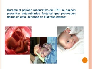 Durante el período madurativo del SNC se pueden
presentar determinados factores que provoquen
daños en ésta, dándose en distintas etapas:
 