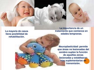 La importancia de un
La mayoría de casos    tratamiento que comience en
tiene posibilidad de         edades tempranas.
   rehabilitación.



                          Neuroplasticidad: permite
                         que áreas no lesionadas del
                          cerebro suplan la función
                              de aquellas zonas
                          lesionadas y establezcan
                           vías suplementarias de
                                 transmisión.
 