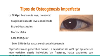 Tipos de Osteogénesis Imperfecta
La OI tipo I es la más leve, presenta:
Fragilidad ósea de leve a moderada
Escleróticas azules
Macrocefalia
Cara triangular
En el 35% de los casos se observa hipoacusia
El pronóstico en general es bueno. La severidad de la OI tipo I puede ser
muy variable, desde individuos sin fracturas, hasta pacientes con
 