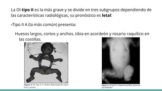 La OI tipo II es la más grave y se divide en tres subgrupos dependiendo de
las características radiológicas, su pronóstico es letal:
-Tipo II A (la más común) presenta:
Huesos largos, cortos y anchos, tibia en acordeón y rosario raquítico en
las costillas.
 