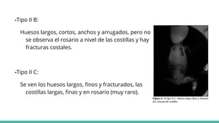 -Tipo II B:
Huesos largos, cortos, anchos y arrugados, pero no
se observa el rosario a nivel de las costillas y hay
fracturas costales.
-Tipo II C:
Se ven los huesos largos, finos y fracturados, las
costillas largas, finas y en rosario (muy raro).
 