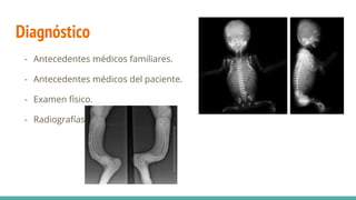 Diagnóstico
- Antecedentes médicos familiares.
- Antecedentes médicos del paciente.
- Examen físico.
- Radiografías.
 