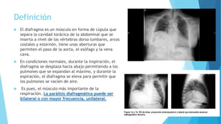 Parálisis diafragmática.pptx