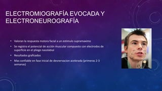 ELECTROMIOGRAFÍA EVOCADA Y
ELECTRONEUROGRAFÍA
• Valoran la respuesta motora facial a un estimulo supramaximo
• Se registra el potencial de acción muscular compuesto con electrodos de
superficie en el pliege nasolabial
• Resultados graficados
• Mas confiable en fase inicial de desnervacion acelerada (primeras 2-3
semanas)

 
