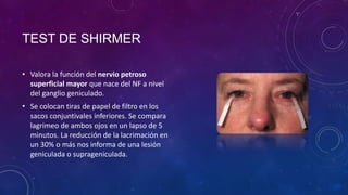 TEST DE SHIRMER
• Valora la función del nervio petroso
superficial mayor que nace del NF a nivel
del ganglio geniculado.
• Se colocan tiras de papel de filtro en los
sacos conjuntivales inferiores. Se compara
lagrimeo de ambos ojos en un lapso de 5
minutos. La reducción de la lacrimación en
un 30% o más nos informa de una lesión
geniculada o suprageniculada.

 