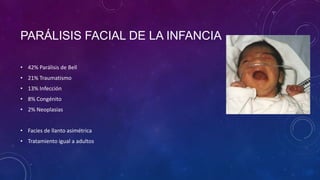 PARÁLISIS FACIAL DE LA INFANCIA
• 42% Parálisis de Bell

• 21% Traumatismo
• 13% Infección
• 8% Congénito
• 2% Neoplasias
• Facies de llanto asimétrica
• Tratamiento igual a adultos

 