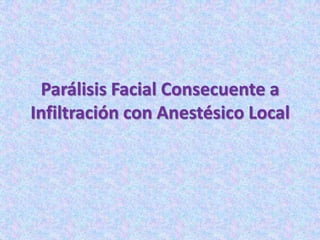 Parálisis Facial Consecuente a
Infiltración con Anestésico Local
 