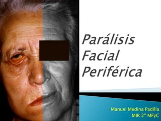 Parálisis Facial Periférica Manuel Medina Padilla MIR 2º MFyC 