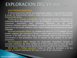 Disminución del numero y tamaño de las papilas gustativas.Suele presentarse con otros signos o síntomas de focalidad neurológica. En diagnostico diferencial y tratamiento de la PFC es de la especialidad de Neurología.Parálisis Facial Periférica