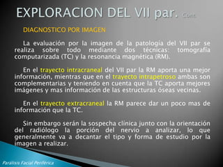 Parálisis Facial Periférica