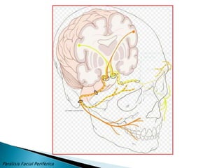 La parálisis facial es una afección frecuente y es importante para el especialista, ya que debe explicar la situación al paciente y calmar su ansiedad considerando que el tratamiento es un tema en controversia.