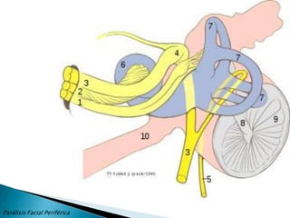 “La cara es el espejo del alma”.CicerónParálisis Facial Periférica