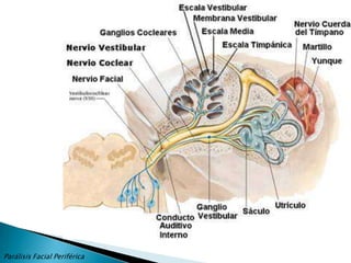 RECUERDO MORFOFUNCIONALLa vía motora del VII se inicia a nivel de la corteza cerebral y finaliza en las placas motoras de los músculos de la expresión facial, así, para un correcto diagnóstico etiológico y topográfico es indispensable conocer la anatomía del VII par craneal.Desde la corteza frontal los impulsos nerviosos descienden para hacer sinapsis con el núcleo del VII par a nivel de la protuberancia.Desde el núcleo del VII par las fibras se dirigen al borde inferior de la protuberancia, pero antes pasan rodeando el núcleo del VI par, y dando el origen aparente del n. Facial.El facial es un nervio mixto que abandona el tronco cerebral por el surco bulboprotuberancial por medio de dos divisiones, una rama motora y el nervio intermediario de Wrisberg, las cuales se unen en el segmento más interno del conducto de Falopio, este conducto presenta dos ángulos que permite dividirlo en tres porciones: primera o laberíntica (3-5mm); segunda o timpánica (10-12 mm) y tercera o mastoidea (13mm).Parálisis Facial Periférica