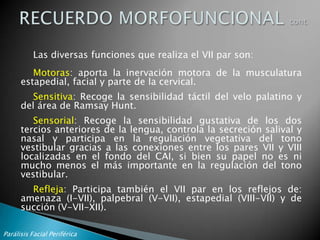 Parálisis Facial Periférica