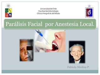 Universidad de Chile
Facultad de Odontología
Clínica Integral de del Adulto
Fabiola Medina P.
Parálisis Facial por Anestesia Local.
 
