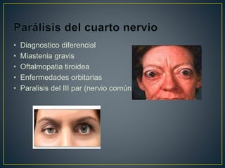 • Diagnostico diferencial
• Miastenia gravis
• Oftalmopatia tiroidea
• Enfermedades orbitarias
• Paralisis del III par (nervio común)
 