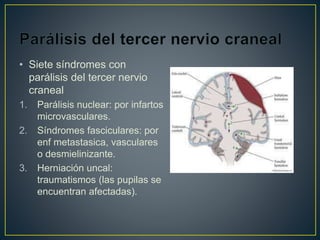 • Siete síndromes con
parálisis del tercer nervio
craneal
1. Parálisis nuclear: por infartos
microvasculares.
2. Síndromes fasciculares: por
enf metastasica, vasculares
o desmielinizante.
3. Herniación uncal:
traumatismos (las pupilas se
encuentran afectadas).
 