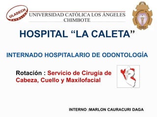 HOSPITAL “LA CALETA”
INTERNADO HOSPITALARIO DE ODONTOLOGÍA
INTERNO :MARLON CAURACURI DAGA
Rotación : Servicio de Cirugía de
Cabeza, Cuello y Maxilofacial
 