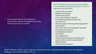 • Causas potenciales de anormalidad en
movimientos oculares, inestabilidad postural y
parkinsonismo que no son PSP
David R Williams, Andrew J Lees. Progressive supranuclear palsy: clinicopathological concepts and diagnostic
challenges. Lancet Neurol 2009; 8: 270–79
 