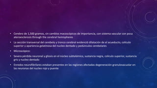 • Cerebro de 1,500 gramos, sin cambios macoscópicos de importancia, con sistema vascular con poca
ateroesclerosis through the cerebral hemispheres
• La sección transversal del cerebelo y tronco cerebral evidenció dilatación de el acueducto, coliculo
superior y apariencia gelatinosa del nucleo dentado y pedúnculos cerebelares
• Microscópico:
• Severa pérdida neuronal y gliosis en el núcleo subtalámico, sustancia negra, coliculo superior, sustancia
gris y nucleo dentado
• Enredos neurofibrilares estaban presentes en las regiones afectadas degeneración granulovacuolar en
las neuronas del nucleo rojo y puente
 