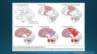 Lancet Neurol 2009; 8: 270–79
 