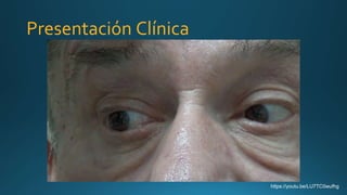 Presentación Clínica
https://youtu.be/LU7TC0wufhg
 