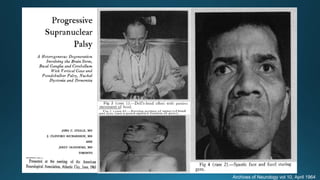Archives of Neurology vol 10, April 1964
 