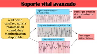 6. El ritmo
cardíaco guía la
reanimación
cuando hay
monitorización
disponible
Descargas externas
sincronizadas con
el QRS
Descargas
asincrónicas
Taquicardia ventricular polimórfica
Fibrilación ventricular:
Taquicardia ventricular
monomórfica
Soporte vital avanzado
 