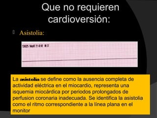 Que no requieren
cardioversión:
 Asistolia:
La asistolía se define como la ausencia completa de
actividad eléctrica en el miocardio, representa una
isquemia miocárdica por periodos prolongados de
perfusion coronaria inadecuada. Se identifica la asistolia
como el ritmo correspondiente a la línea plana en el
monitor
 