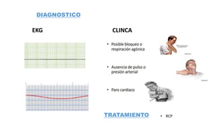DIAGNOSTICO
EKG CLINCA
TRATAMIENTO • RCP
 