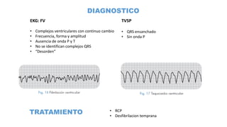 EKG: FV
• Complejos ventriculares con continuo cambio
• Frecuencia, forma y amplitud
• Ausencia de onda P y T
• No se identifican complejos QRS
• “Desorden”
TVSP
• QRS ensanchado
• Sin onda P
DIAGNOSTICO
TRATAMIENTO • RCP
• Desfibrilacion temprana
 