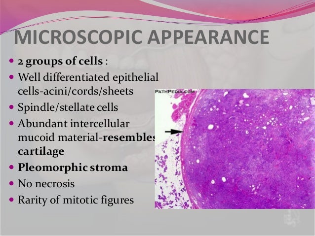 pleomorphic adenoma