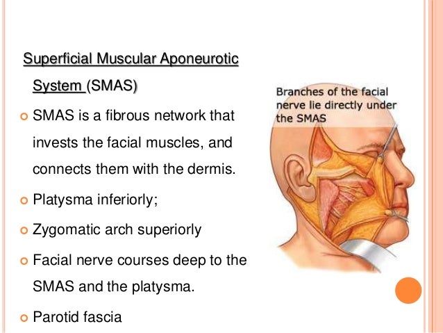 parotidectomy