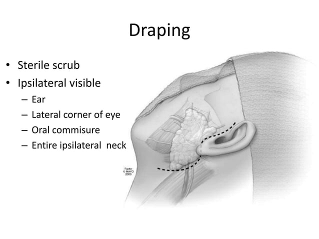 Parotid Incision Types Parotidectomy : Operative Technique | PPTX