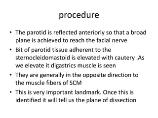 Parotidectomy