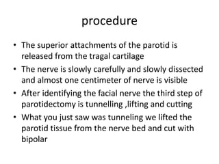 Parotidectomy