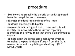 Parotidectomy