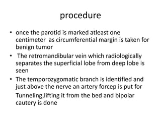Parotidectomy