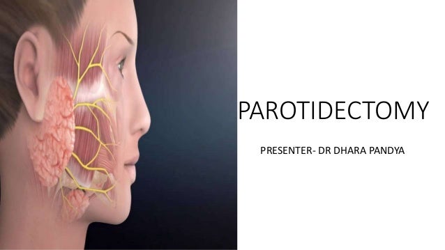 PAROTIDECTOMY
PRESENTER- DR DHARA PANDYA
 