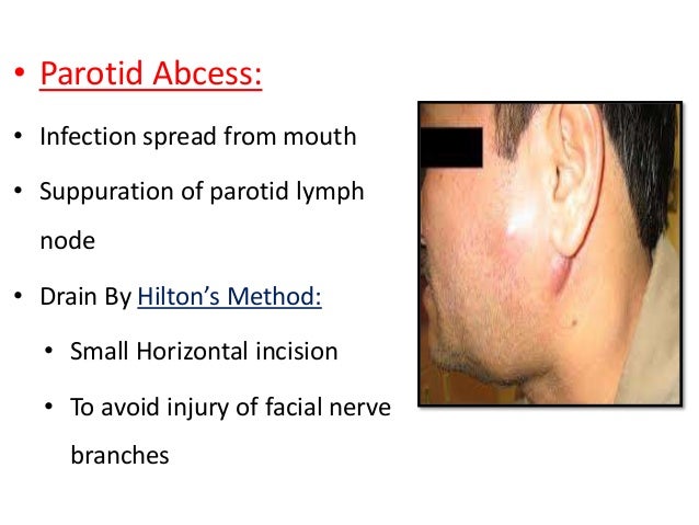Parotid Gland Facial Nerve