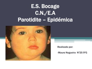 E.S. BocageC.N./E.AParotidite – Epidémica Realizado por:   -Mauro Nogueira  Nº25 9ºG 
