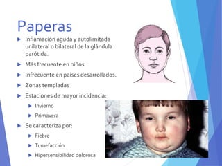 Paperas Inflamadas Parotiditis | PPTX