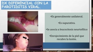 DX DIFERENCIAL CON LA
PAROTIDITIS VIRAL.
•Es generalmente unilateral.
•Es supurativa.
•Se asocia a leucocitosis neurtofilico
•Enrojecimiento de la piel que
recubre la lesión.
 