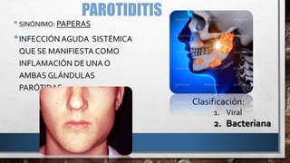 PAROTIDITIS
•SINÓNIMO: PAPERAS
•INFECCIÓN AGUDA SISTÉMICA
QUE SE MANIFIESTA COMO
INFLAMACIÓN DE UNA O
AMBAS GLÁNDULAS
PARÓTIDAS.
Clasificación:
1. Viral
2. Bacteriana
 