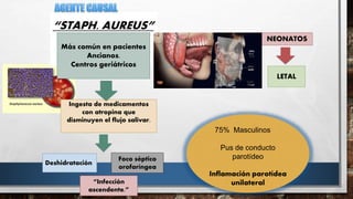 “STAPH. AUREUS”
Más común en pacientes
Ancianos.
Centros geriátricos
Ingesta de medicamentos
con atropina que
disminuyen el flujo salivar.
Deshidratación
Foco séptico
orofaríngea
“Infección
ascendente.”
NEONATOS
LETAL
75% Masculinos
Pus de conducto
parotídeo
Inflamación parotídea
unilateral
 